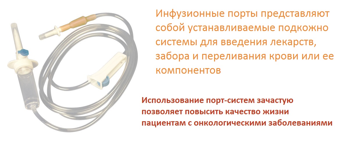 Установка венозных порт систем